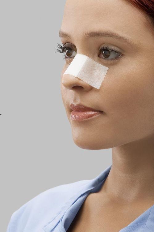 鼻子打玻尿酸视频,轻松打造立体美鼻全过程揭秘